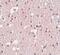 FERM And PDZ Domain Containing 3 antibody, PA5-20840, Invitrogen Antibodies, Immunohistochemistry paraffin image 