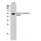 Keratin 8 antibody, LS-C380590, Lifespan Biosciences, Western Blot image 