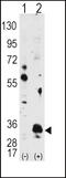 Pim-1 Proto-Oncogene, Serine/Threonine Kinase antibody, 63-294, ProSci, Western Blot image 