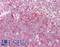 ELOVL Fatty Acid Elongase 5 antibody, LS-B7696, Lifespan Biosciences, Immunohistochemistry frozen image 