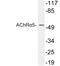 Cholinergic Receptor Nicotinic Alpha 5 Subunit antibody, LS-C199758, Lifespan Biosciences, Western Blot image 