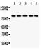 Collagen Type IV Alpha 1 Chain antibody, PA1536-1, Boster Biological Technology, Western Blot image 