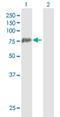 Peptidyl Arginine Deiminase 3 antibody, H00051702-B01P, Novus Biologicals, Western Blot image 