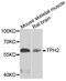 Tryptophan Hydroxylase 2 antibody, abx005394, Abbexa, Western Blot image 