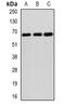 Suppressor Of Cytokine Signaling 4 antibody, abx142237, Abbexa, Western Blot image 