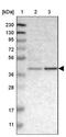 Carbonic Anhydrase 4 antibody, NBP1-88225, Novus Biologicals, Western Blot image 