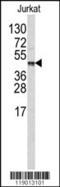 TAFI antibody, 62-311, ProSci, Western Blot image 