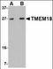 Transmembrane Protein 18 antibody, orb94270, Biorbyt, Western Blot image 