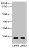 Phosphodiesterase 6D antibody, CSB-PA526126LA01HU, Cusabio, Western Blot image 