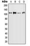 MYB Proto-Oncogene Like 2 antibody, MBS822257, MyBioSource, Western Blot image 