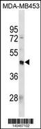 Programmed Cell Death 2 Like antibody, 60-550, ProSci, Western Blot image 