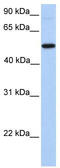 Polypeptide N-Acetylgalactosaminyltransferase 13 antibody, TA342072, Origene, Western Blot image 