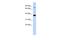 Zinc Finger Protein 526 antibody, A16329, Boster Biological Technology, Western Blot image 