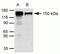 Regulatory Associated Protein Of MTOR Complex 1 antibody, 42-4000, Invitrogen Antibodies, Immunoprecipitation image 