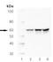 SRC Proto-Oncogene, Non-Receptor Tyrosine Kinase antibody, LS-B3266, Lifespan Biosciences, Western Blot image 