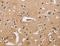 Calcium-transporting ATPase type 2C member 1 antibody, LS-C401435, Lifespan Biosciences, Immunohistochemistry paraffin image 