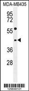 Epoxide Hydrolase 3 antibody, 55-957, ProSci, Western Blot image 