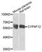 Cytochrome P450 Family 4 Subfamily F Member 12 antibody, A7993, ABclonal Technology, Western Blot image 