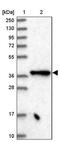 Elongator Acetyltransferase Complex Subunit 4 antibody, PA5-58445, Invitrogen Antibodies, Western Blot image 