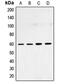 SMAD Family Member 4 antibody, MBS822108, MyBioSource, Western Blot image 