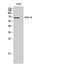 Interleukin 1 Receptor Associated Kinase 3 antibody, STJ93758, St John