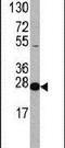 Eukaryotic translation initiation factor 4E antibody, PA5-11797, Invitrogen Antibodies, Western Blot image 