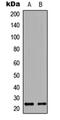 Heart And Neural Crest Derivatives Expressed 1 antibody, abx121410, Abbexa, Western Blot image 