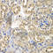 Sulfotransferase Family 2B Member 1 antibody, A7736, ABclonal Technology, Immunohistochemistry paraffin image 