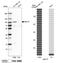 Melanotransferrin antibody, PA5-52127, Invitrogen Antibodies, Western Blot image 