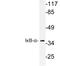 NFKB Inhibitor Alpha antibody, LS-C177650, Lifespan Biosciences, Western Blot image 