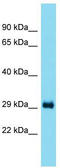 Translational Activator Of Cytochrome C Oxidase I antibody, TA332197, Origene, Western Blot image 