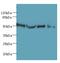 Tetratricopeptide Repeat Domain 38 antibody, A61594-100, Epigentek, Western Blot image 