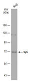 Spleen Associated Tyrosine Kinase antibody, GTX633910, GeneTex, Western Blot image 