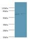 TNF Receptor Superfamily Member 21 antibody, LS-C376901, Lifespan Biosciences, Western Blot image 