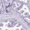 Calcyphosine Like antibody, HPA046811, Atlas Antibodies, Immunohistochemistry paraffin image 
