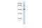 Glutaminyl-Peptide Cyclotransferase Like antibody, GTX46328, GeneTex, Western Blot image 