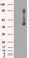 Glucokinase antibody, NBP1-47778, Novus Biologicals, Western Blot image 