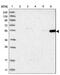 Fibroblast Growth Factor Receptor Substrate 3 antibody, PA5-56375, Invitrogen Antibodies, Western Blot image 