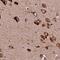 Lysyl-TRNA Synthetase antibody, PA5-59620, Invitrogen Antibodies, Immunohistochemistry frozen image 