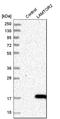 Endosomal adaptor protein p14 antibody, HPA004126, Atlas Antibodies, Western Blot image 