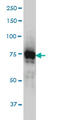 Interleukin 1 Receptor Associated Kinase 1 antibody, LS-B4360, Lifespan Biosciences, Western Blot image 