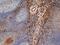 Mannose Receptor C-Type 1 antibody, GTX42266, GeneTex, Immunohistochemistry frozen image 
