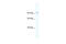 Phosphatidylinositol-4,5-Bisphosphate 3-Kinase Catalytic Subunit Beta antibody, 27-502, ProSci, Enzyme Linked Immunosorbent Assay image 