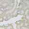 Mesothelin antibody, 15-369, ProSci, Immunohistochemistry frozen image 
