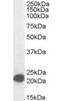 MYC Associated Factor X antibody, orb18299, Biorbyt, Western Blot image 