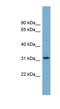 Olfactory Receptor Family 2 Subfamily AT Member 4 antibody, NBP1-59861, Novus Biologicals, Western Blot image 