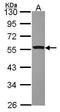 RB Binding Protein 4, Chromatin Remodeling Factor antibody, PA5-30422, Invitrogen Antibodies, Western Blot image 