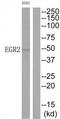 Early Growth Response 2 antibody, TA326135, Origene, Western Blot image 