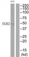 KROX20 antibody, TA326135, Origene, Western Blot image 