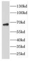 Essential Meiotic Structure-Specific Endonuclease 1 antibody, FNab02752, FineTest, Western Blot image 